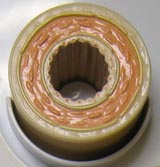 Normal Artery